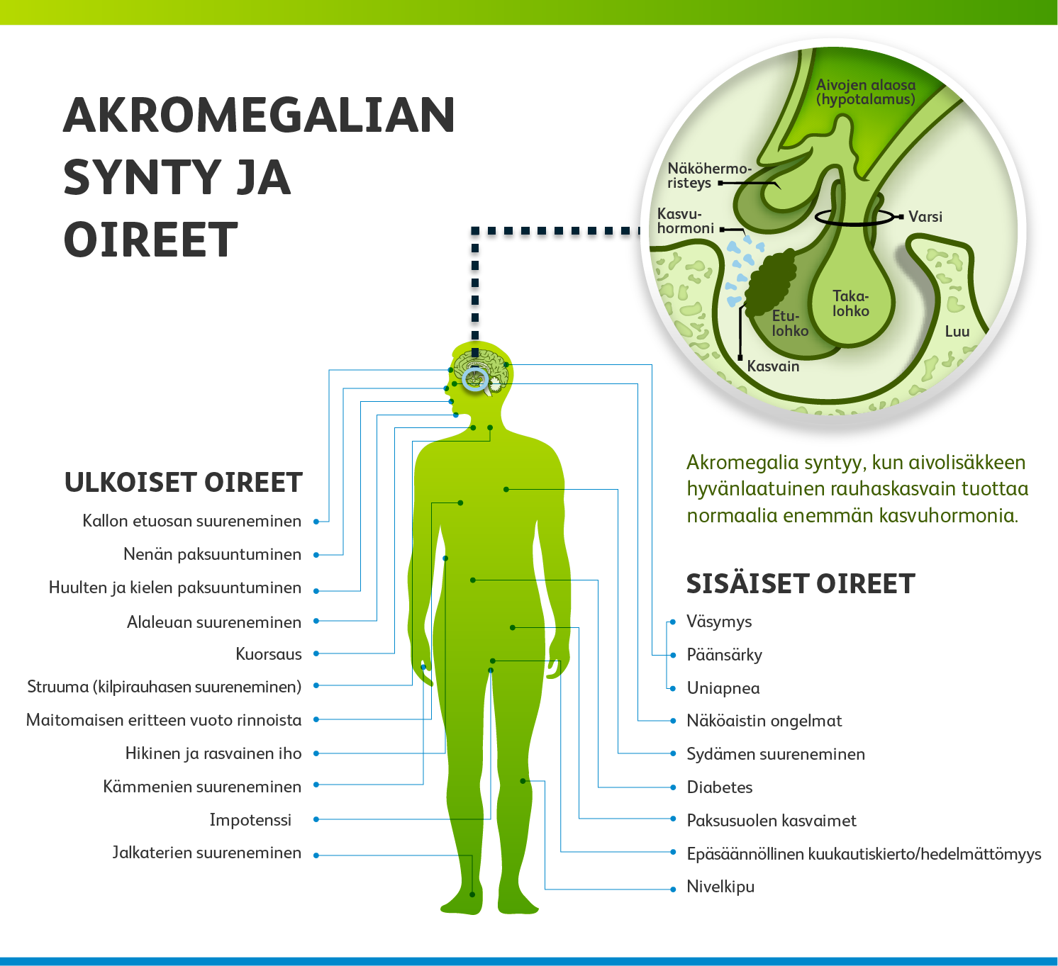 akromegalian synty ja oireet